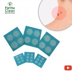 Formuclear Skin Tag Patch Wart Removal Remedy