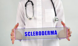 SCLERODERMA