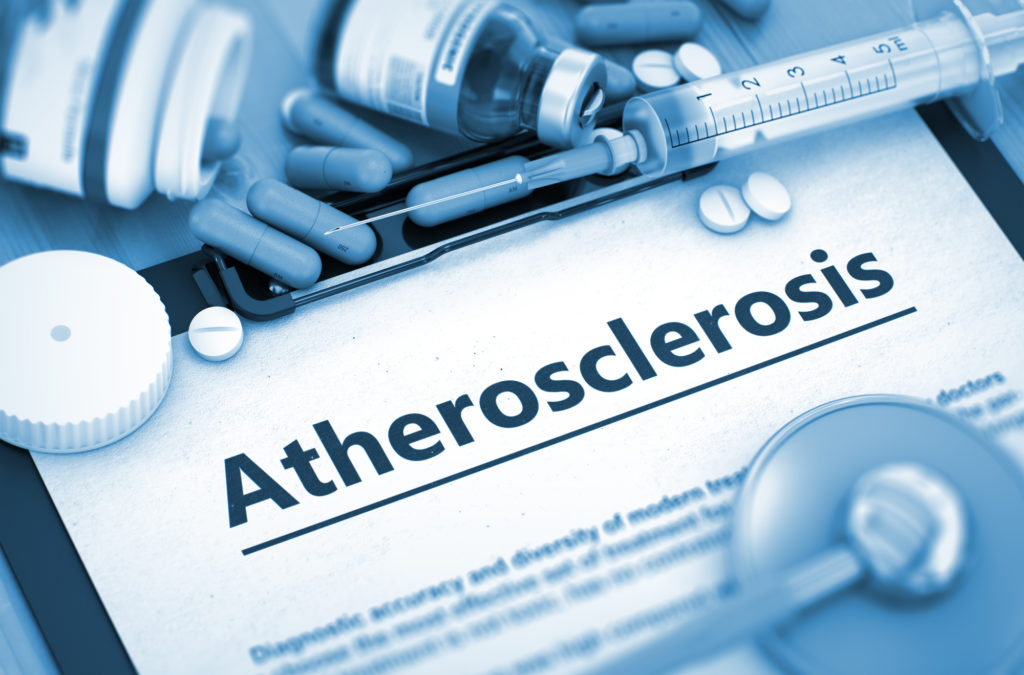 Atherosclerosis