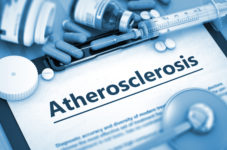 Atherosclerosis