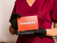 Scleroderma